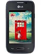 LG L35